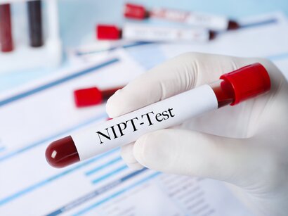 Badania prenatalne: NIPT czy PAPPA?